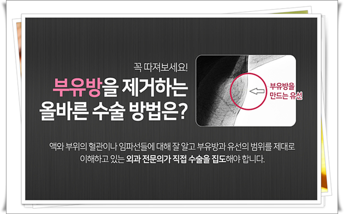 겨드랑이부유방 튀어나와 있다면? 관련 이미지 4