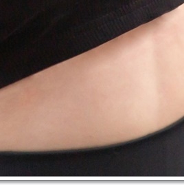Breast Sagging Surgery to Regain Firmness image 22
