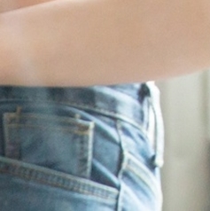 복부성형 기대를 한다면 관련 이미지 26