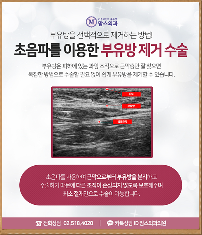 부유방수술잘하는곳 당연히 찾아야지! 관련 이미지 8