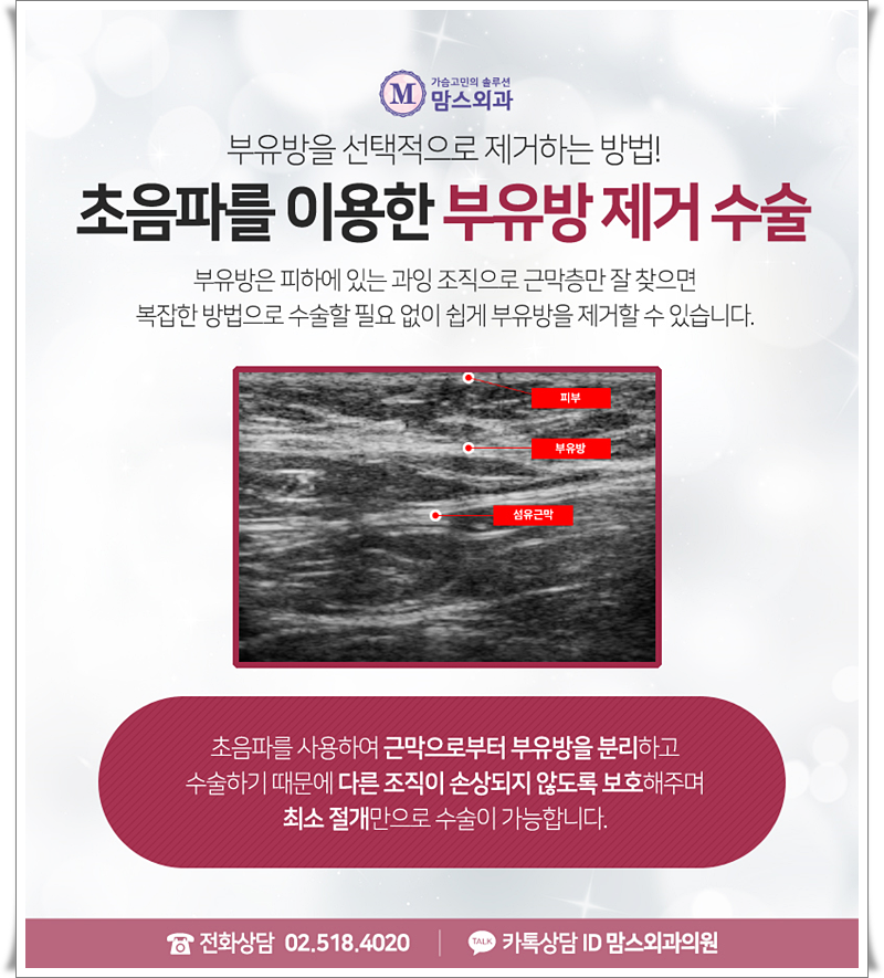 부유방살빼기 가능할까요? 관련 이미지 8