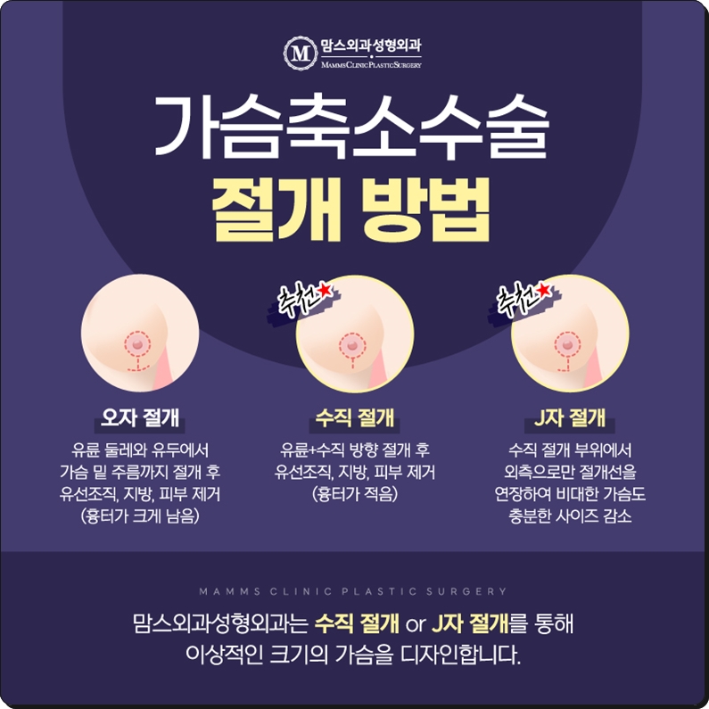 가슴축소수술병원 흉터에 대한 근심을 털어두고 관련 이미지 5