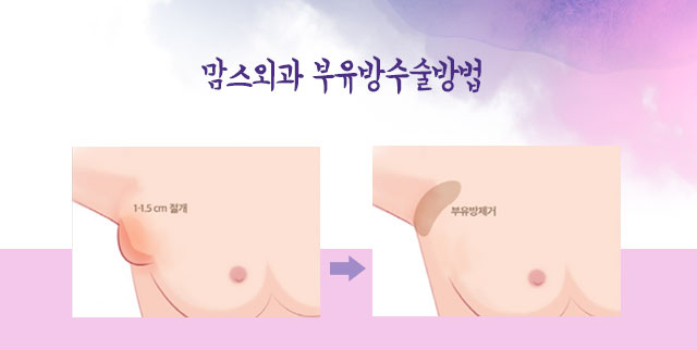 임신부유방 왜이런거죠 관련 이미지 6