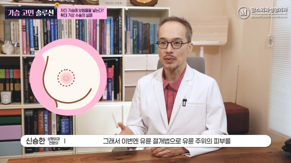 처진 가슴에 보형물을 넣는다? 확대 거상 수술의 실패 관련 이미지 9
