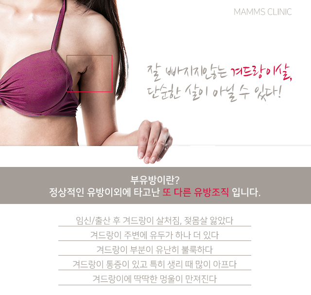 부유방운동 아무리해도안빠진다면 관련 이미지 2