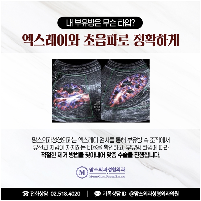 겨드랑이지방흡입 자꾸만 생각이 난다면? 관련 이미지 6