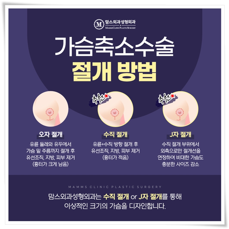 가슴축소수술후관리도 든든한 곳을 찾아가기 관련 이미지 6