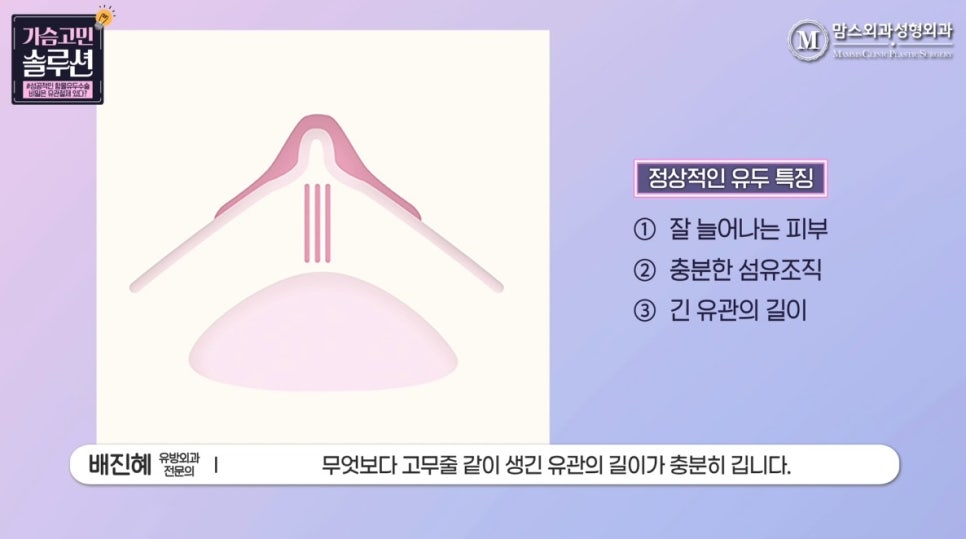 함몰유두수술의 성공을 위한 포인트는? 관련 이미지 4