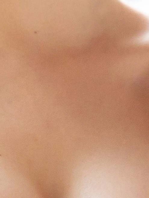 If Nipple Inversion Surgery Is Difficult image 18