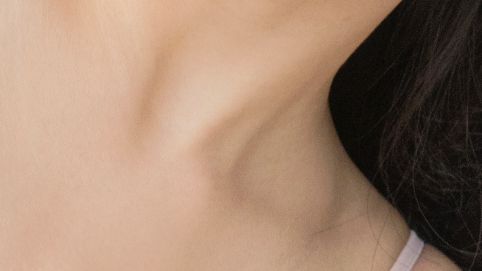 A Complete Solution That Integrates Every Step, from Consultation to Aftercare, for Breast Lift Surgery! image 18