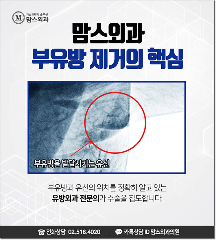 부유방제거비용 부담을 줄일 수 있나요? 관련 이미지 8