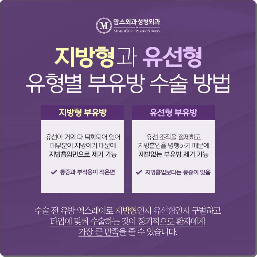 부유방제거수술 내게 맞는 것으로 관련 이미지 5