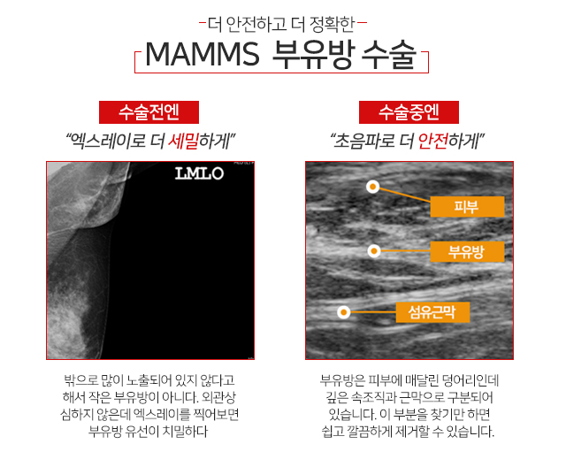 겨드랑이 밑 통증 큰일은아닐까 관련 이미지 3