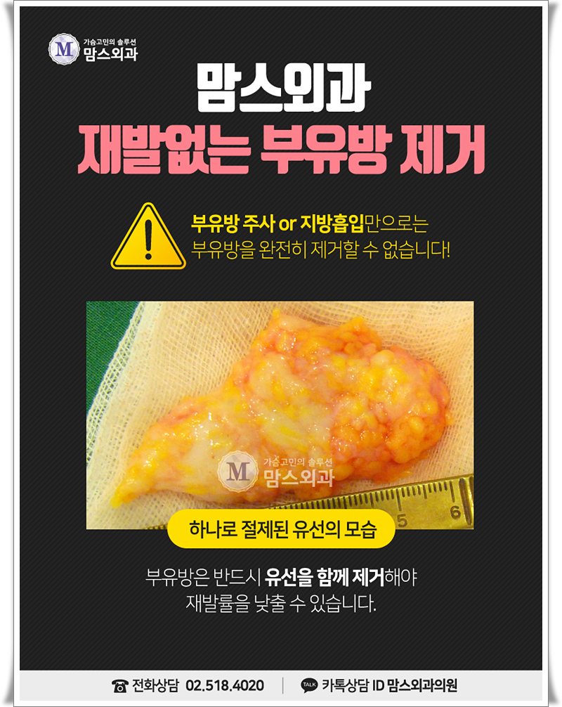 부유방수술 부담이 됐다면! 관련 이미지 6