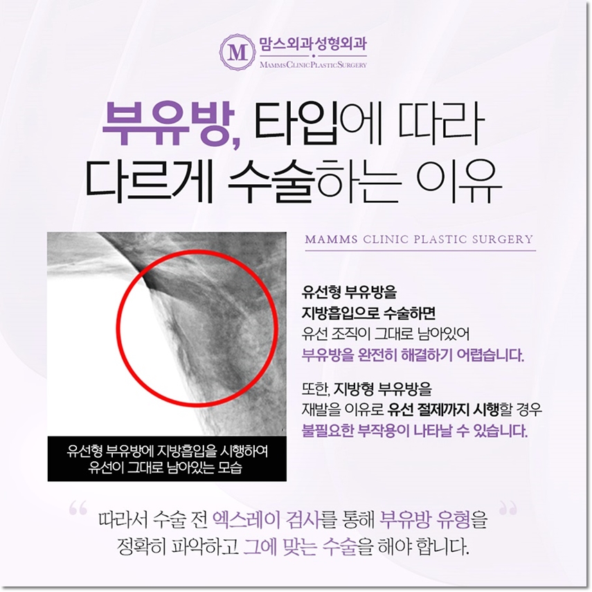 Why Does My Armpit Hurt? image 7