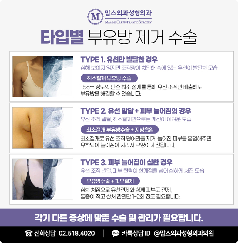 부유방통증 잘 살펴보세요! 관련 이미지 8