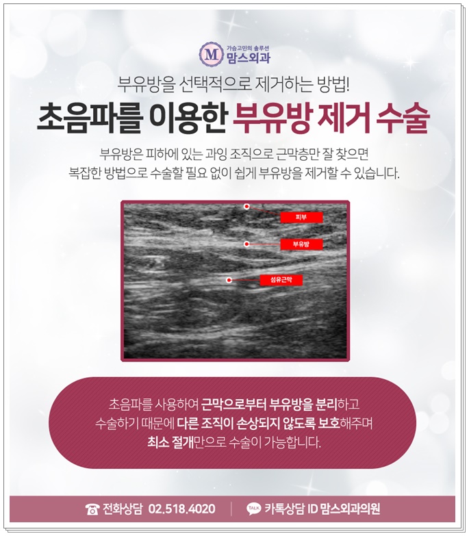 부유방수술 제대로 알고 결정하자! 관련 이미지 6