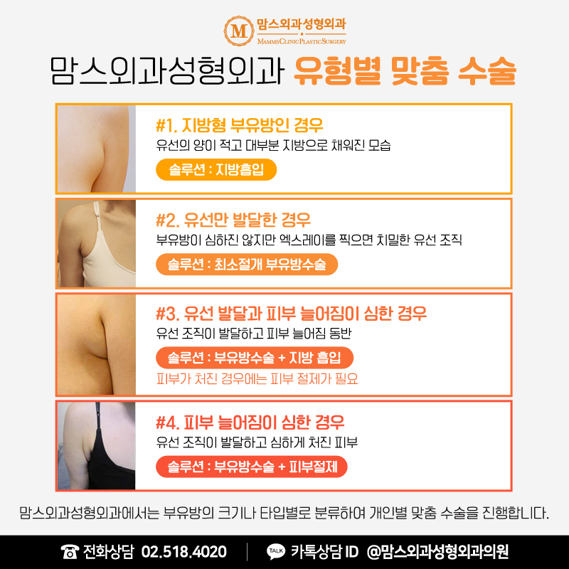 When Is Axillary Breast Tissue Liposuction Possible? image 5