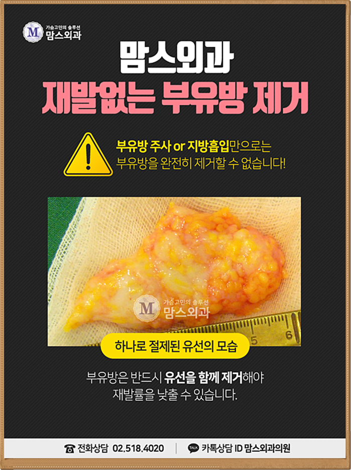 부유방수술잘하는곳 당연히 찾아야지! 관련 이미지 6