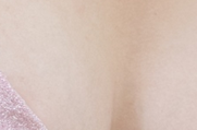 겨드랑이 몽우리 걱정스럽나요? 관련 이미지 26