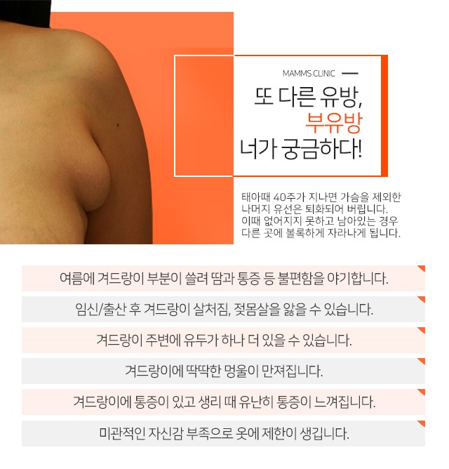 부유방제거병원 한번에꼼꼼하게 관련 이미지 2