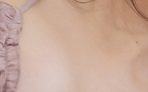 Why Should You Choose Accessory Breast Surgery Instead of Accessory Breast Injections? image 17