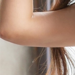 부유방지방흡입 무엇을 기준으로? 관련 이미지 18