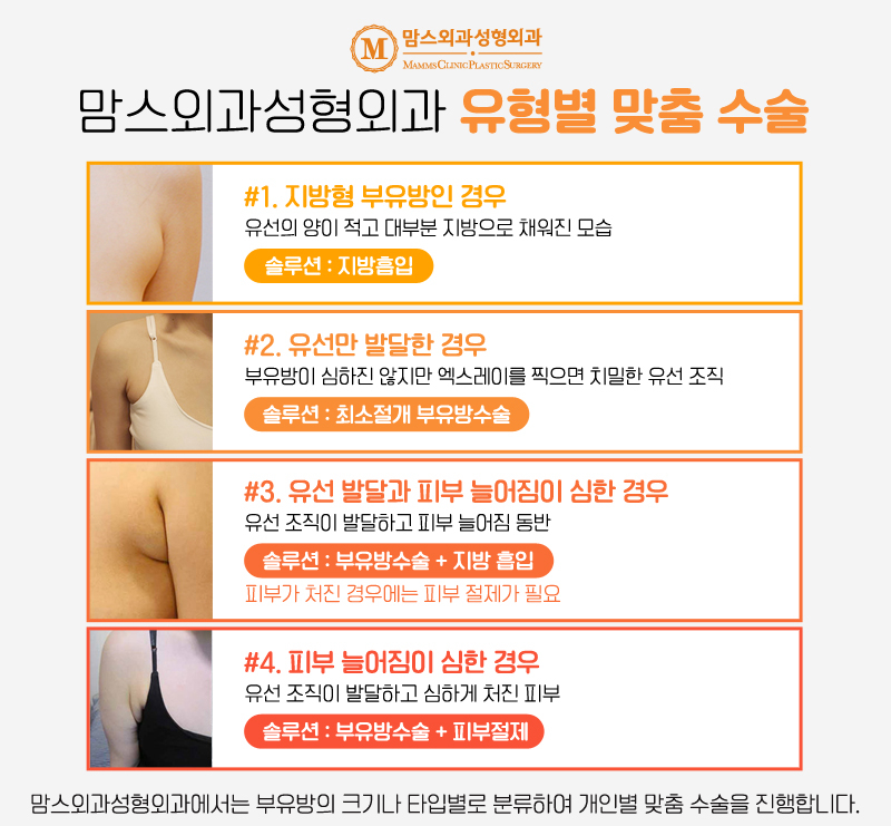 겨드랑이부유방 유형에 따라 다른 치료 방법이 중요한 이유! 관련 이미지 4