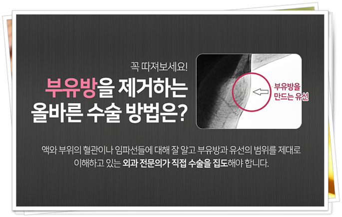 겨드랑이멍울 시선이 신경 쓰이죠 관련 이미지 5
