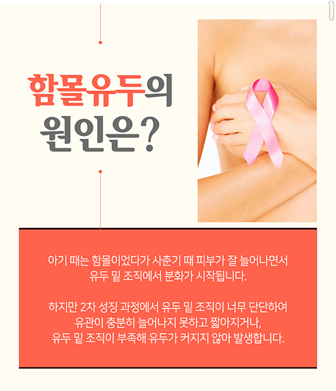 함몰유두수술후기 어떻게 변할까 관련 이미지 3