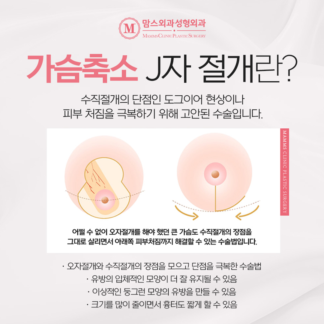 Effectively Improve Postpartum Sagging Breasts with a J-Incision! image 3