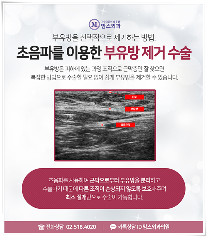 부유방제거수술비용 어느새 매끄럽게! 관련 이미지 6