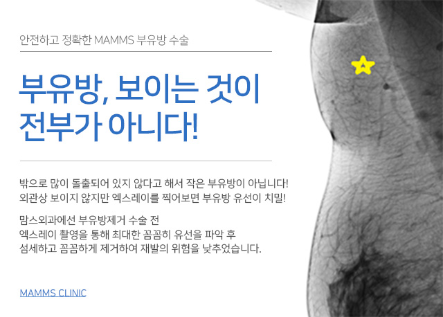 겨드랑이살 통증이함께있다면 관련 이미지 4