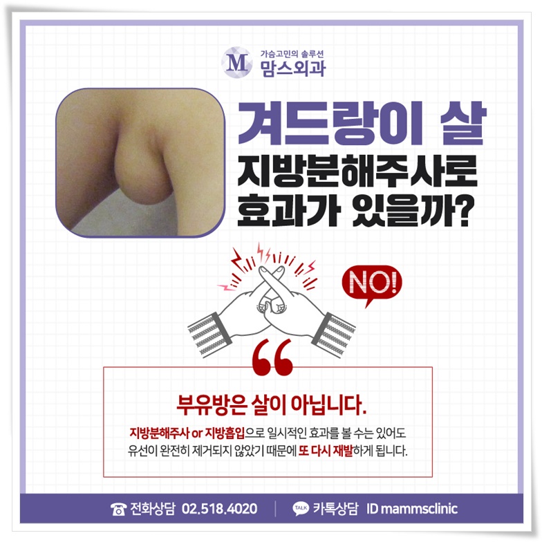 부유방제거로 삶의 질을 위해 관련 이미지 5