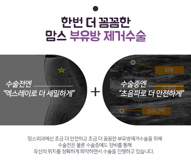 겨드랑이혹 너무걱정마세요 관련 이미지 6