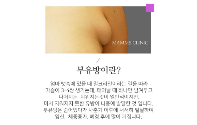 부유방원인 정확하게알아봐요 관련 이미지 2