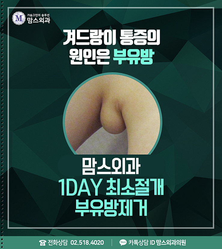 겨드랑이부유방수술 이제는 매끈하자! 관련 이미지 1