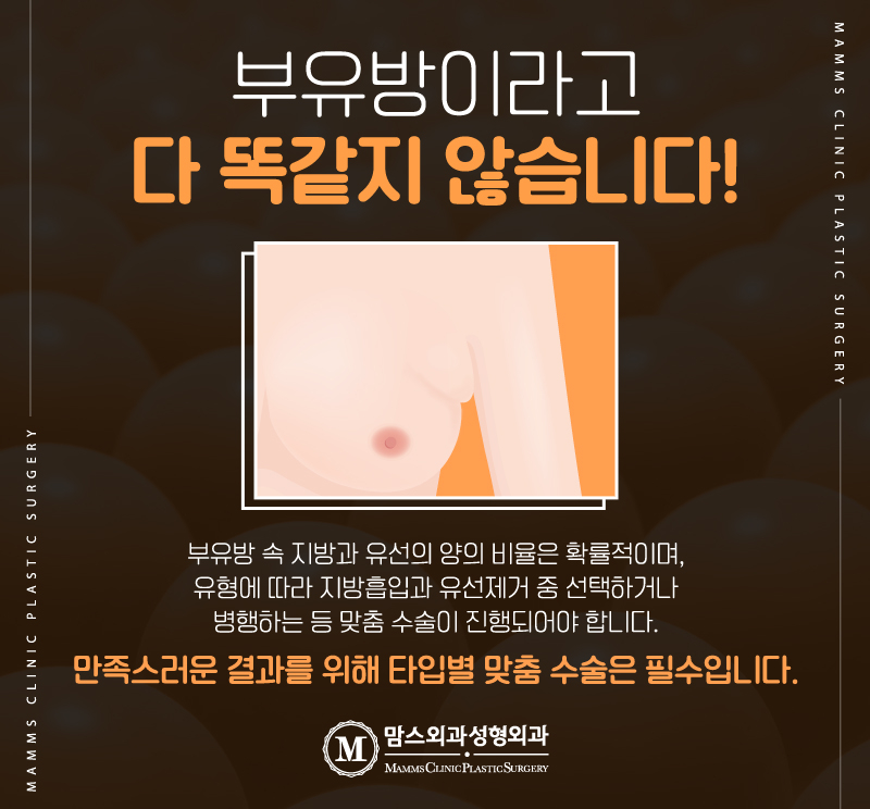 겨드랑이지방흡입 부유방제거는 병원과 전문의 선택이 정말 중요합니다 관련 이미지 4