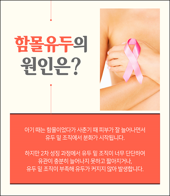 함몰유두교정 시선에 부담되니까 관련 이미지 3