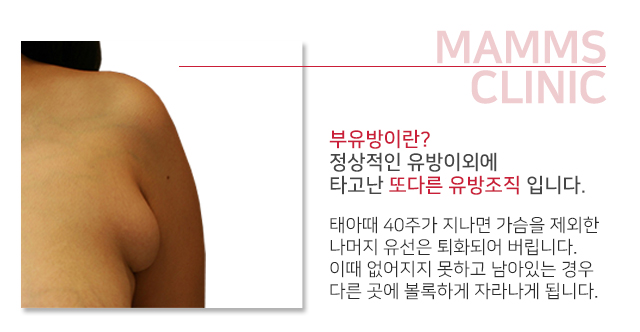 겨드랑이 혹 걱정도떼어버리자 관련 이미지 2