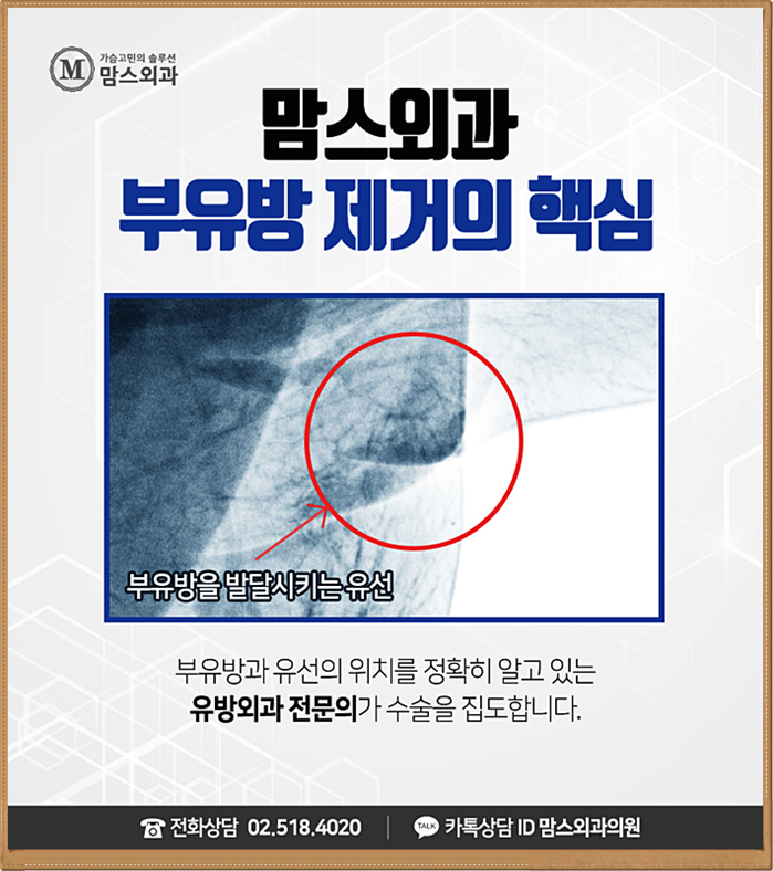 부유방수술잘하는곳 당연히 찾아야지! 관련 이미지 7