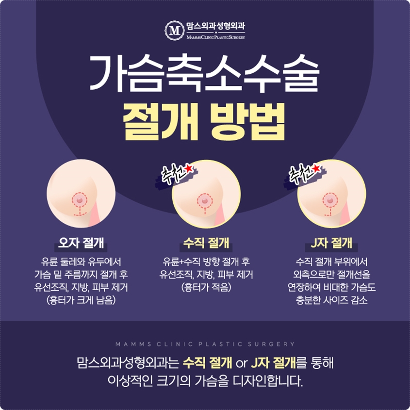 가슴축소수술 흉터 제대로 생각해야해요! 관련 이미지 3
