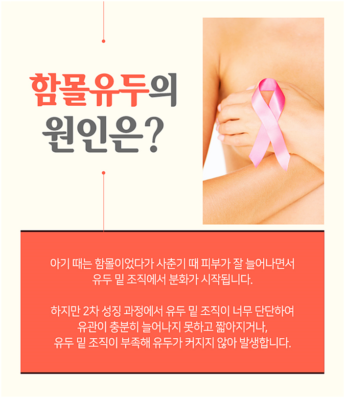 유두성형 더 당당해질 수 있지 관련 이미지 3