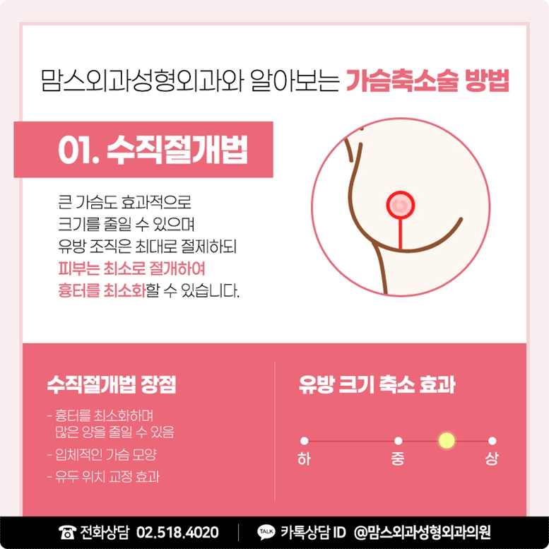 가슴축소수술, 수직절개로 나중까지 생각하면! 관련 이미지 8