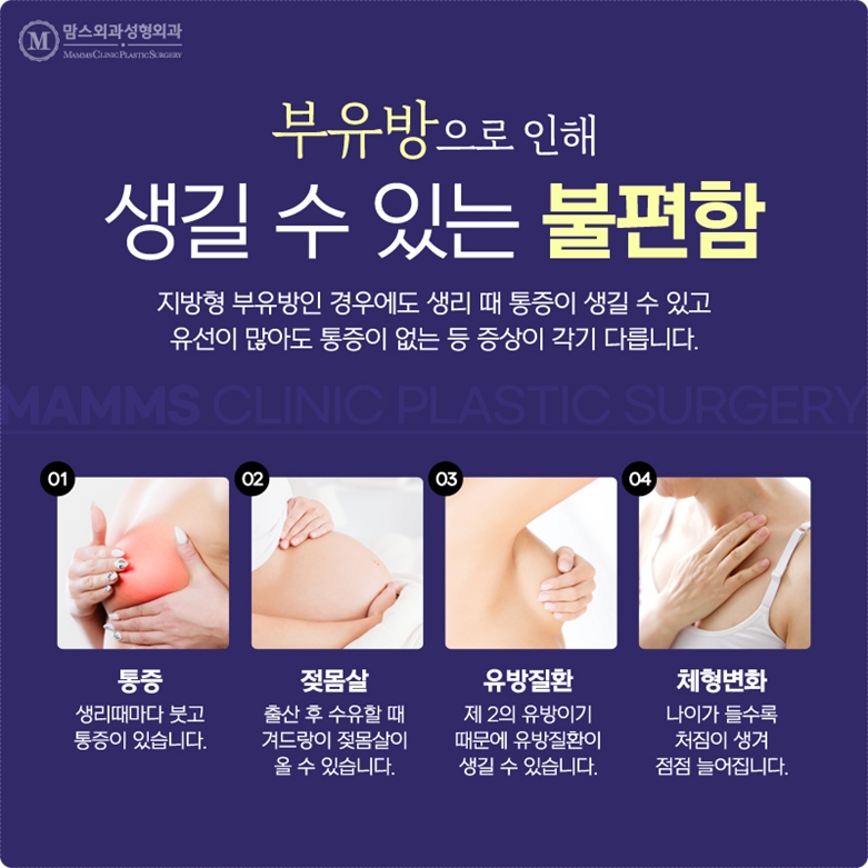 부유방지방흡입 무엇을 기준으로? 관련 이미지 3