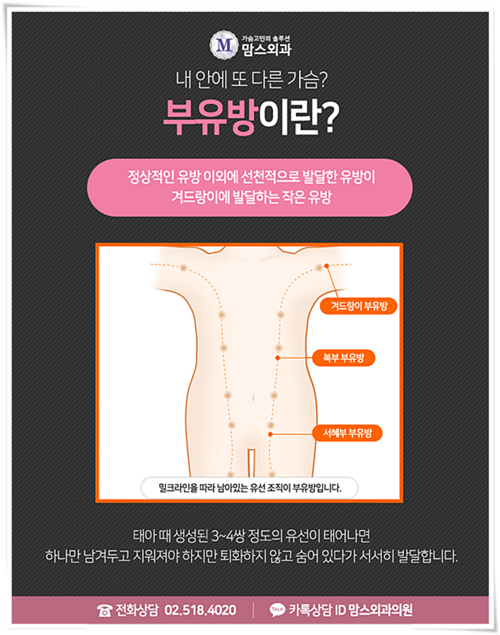 부유방제거수술비용 어느새 매끄럽게! 관련 이미지 2