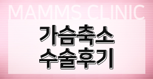 가슴축소수술후기 나에게맞게 관련 이미지 6