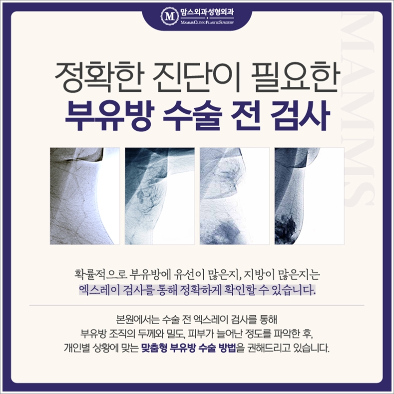 겨드랑이지방흡입 자꾸만 생각이 난다면? 관련 이미지 7