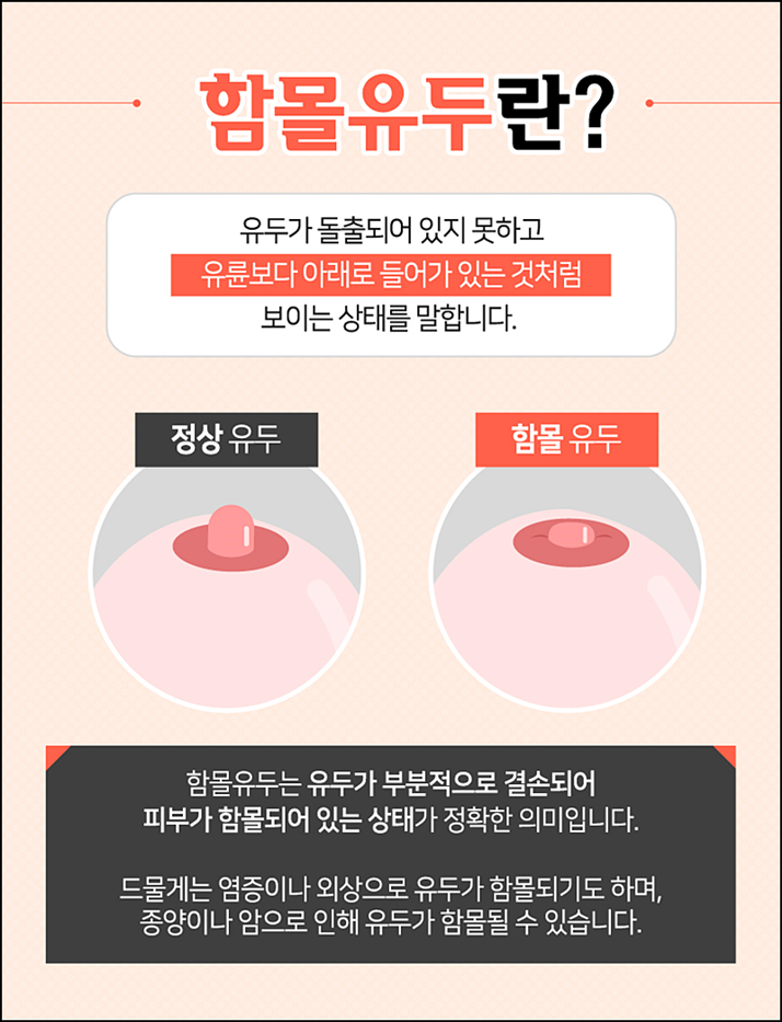 함몰유두교정 시선에 부담되니까 관련 이미지 2