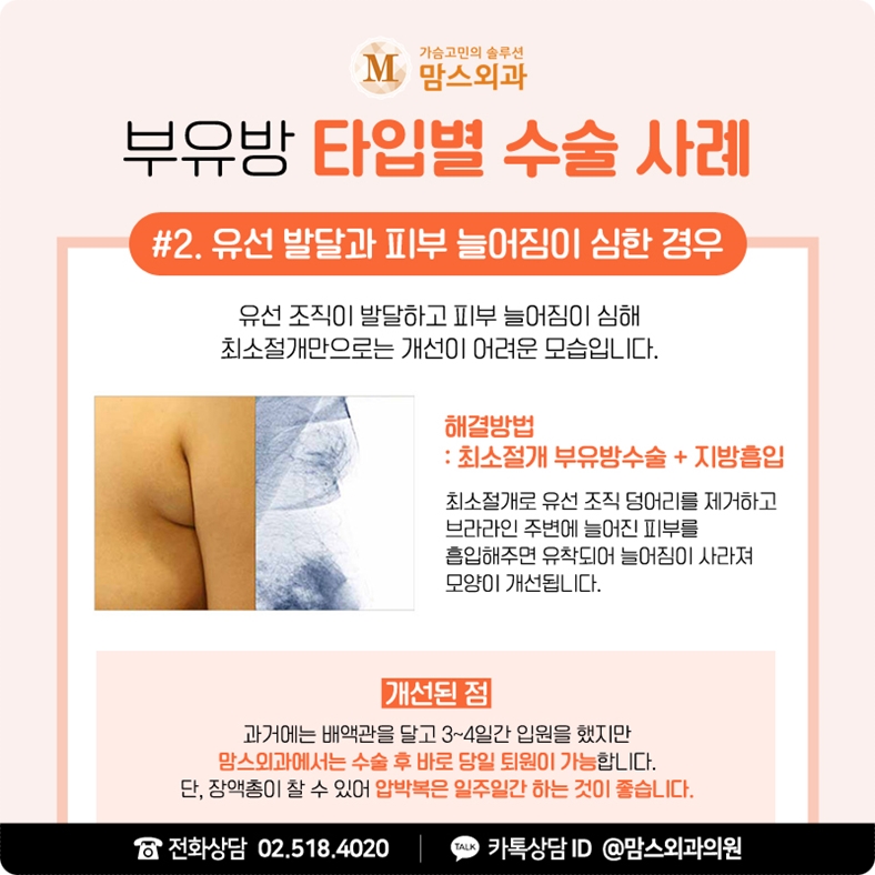 겨드랑이 멍울 자국 걱정 없이 깔끔하게! 관련 이미지 8